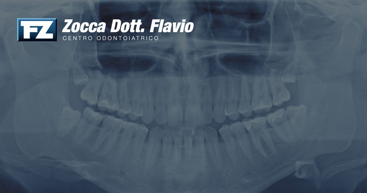 Il Blog 21 Radiografie dentali: sono davvero pericolose? Tutto quello che devi sapere