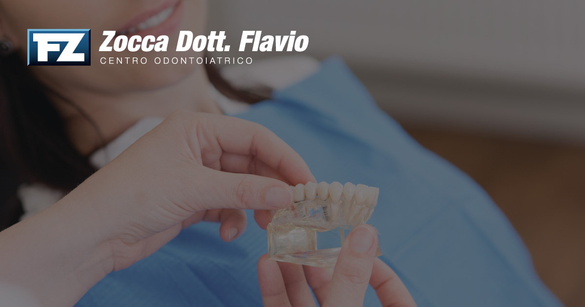 Impianti dentali nel 2026: come funzionano, durata e recupero