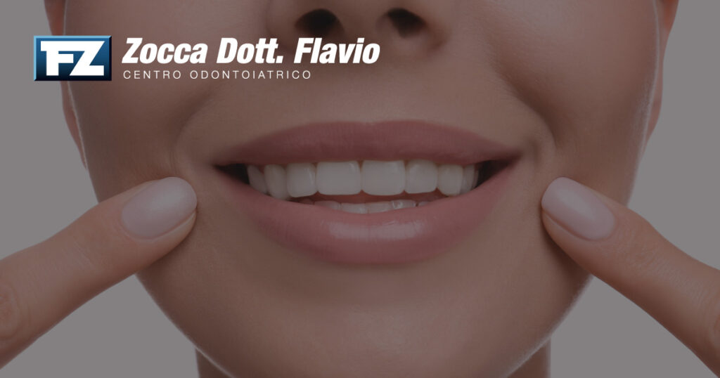Faccette dentali: la guida completa per un sorriso perfetto nel 2026