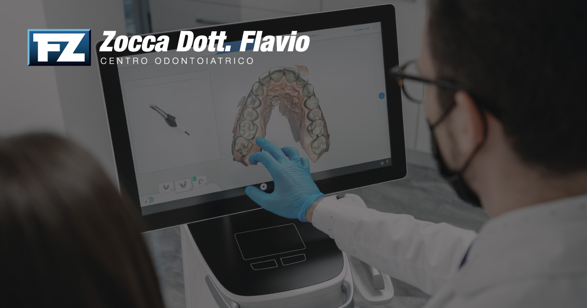 Il Blog 2 Impronta dentale digitale: cos'è e come funziona